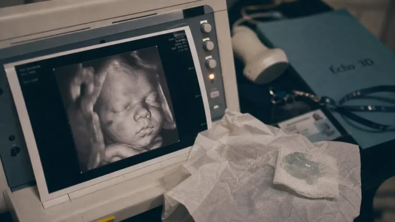 Echo 3D et realite : rendu échographie 3D sur écran